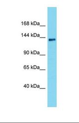 Western blot of Human MCF7. INTS2 antibody dilution 1.0 ug/ml.