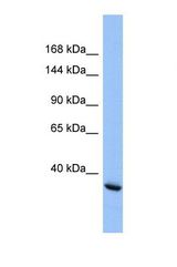 Western blot of Human HepG2. INTS4 antibody dilution 1.0 ug/ml.