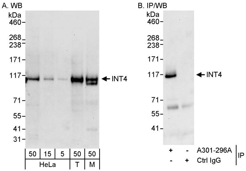 Detection of Human and Mouse INT4 by Western Blot (h&m) and Immunoprecipitation (h). Samples: Whole cell lysate from HeLa (5, 15 and 50 ug for WB; 1 mg for IP, 20% of IP loaded), 293T (T; 50 ug) and mouse NIH3T3 (M; 50 ug) cells. Antibody: Affinity purified rabbit anti-INT4 antibody used for WB at 0.4 ug/ml (A) and 1 ug/ml (B) and used for IP at 3 ug/mg lysate. Detection: Chemiluminescence with exposure times of 30 seconds (A and B).
