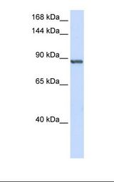 Placenta lysate. Antibody concentration: 1.0 ug/ml. Gel concentration: 6-18%.