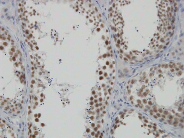 Immunoperoxidase of monoclonal antibody to DDX26 on formalin-fixed paraffin-embedded human testis. [antibody concentration 3 ug/ml]