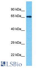 INTS9 antibody Western Blot of MCF7. Antibody dilution: 1 ug/ml.