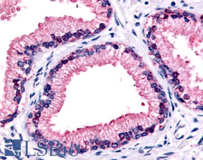 Anti-GPR87 antibody LS-A1584 IHC of human prostate, epithelium. Immunohistochemistry of formalin-fixed, paraffin-embedded tissue after heat-induced antigen retrieval.