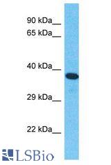 IOP1 / NARFL antibody Western Blot of ACHN. Antibody dilution: 1 ug/ml.