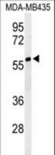 Western blot of NARFL Antibody in MDA-MB435 cell line lysates (35 ug/lane). NARFL (arrow) was detected using the purified antibody.