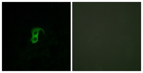 Immunofluorescence of HUVEC cells, using GPR87 Antibody. The picture on the right is treated with the synthesized peptide.