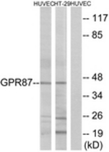 Western blot of extracts from HUVEC/HT-29 cells, using GPR87 Antibody. The lane on the right is treated with the synthesized peptide.