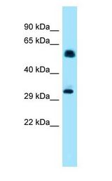 IP6K1 antibody Western Blot of Mouse Heart.