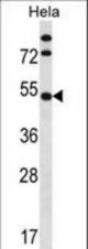 IP6K1 Antibody western blot of HeLa cell line lysates (35 ug/lane). The IP6K1 antibody detected the IP6K1 protein (arrow).
