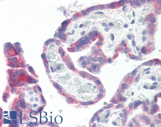 Anti-GPR87 antibody IHC of human placenta. Immunohistochemistry of formalin-fixed, paraffin-embedded tissue after heat-induced antigen retrieval. Antibody LS-B8094 dilution 5-10 ug/ml.