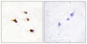 IHC of paraffin-embedded human brain tissue, using IP6K3 Antibody. The picture on the right is treated with the synthesized peptide.