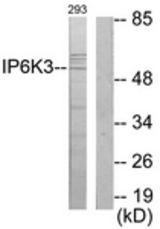 Western blot of extracts from 293 cells, using IP6K3 Antibody. The lane on the right is treated with the synthesized peptide.