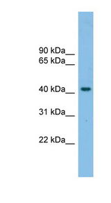 GPR87 antibody LS-B8094 Western blot of NCI-H226 cell lysate.