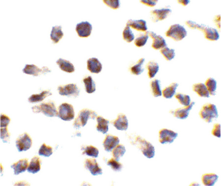 Immunocytochemistry of Ipaf in THP-1 cells with Ipaf antibody at 10 ug/ml.