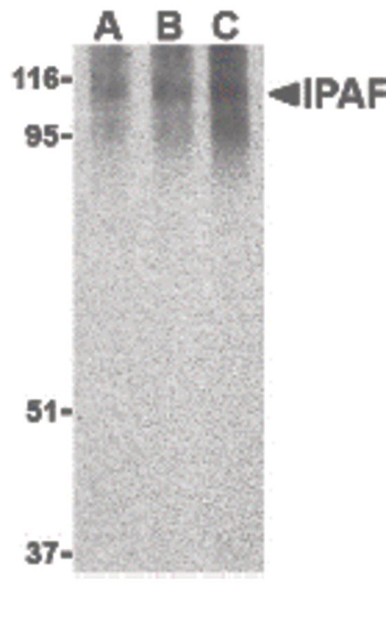 Western blot of Ipaf in human PBL lysate with Ipaf antibody at 0.5 (lane A), 1 (lane B), and 2 (lane C) ug/ml, respectively.