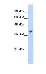 HepG2 cell lysate. Antibody concentration: 2.5 ug/ml. Gel concentration: 12%.
