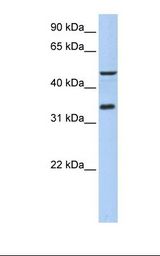 721_B cell lysate. Antibody concentration: 1.0 ug/ml. Gel concentration: 12%.