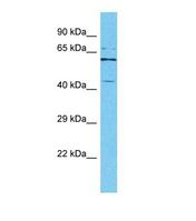 Western blot of Human HeLa. IPMK antibody dilution 1.0 ug/ml.