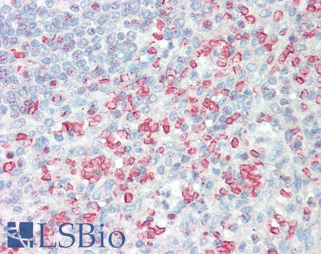 Anti-IPMK antibody IHC staining of human spleen. Immunohistochemistry of formalin-fixed, paraffin-embedded tissue after heat-induced antigen retrieval. Antibody LS-B9968 concentration 10 ug/ml.
