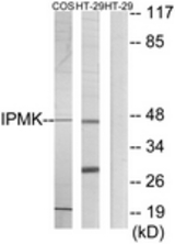 Western blot of extracts from HT-29/COS7 cells, using IPMK Antibody. The lane on the right is treated with the synthesized peptide.