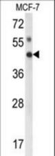 Western blot of IPMK Antibody in MCF-7 cell line lysates (35 ug/lane). IPMK (arrow) was detected using the purified antibody.