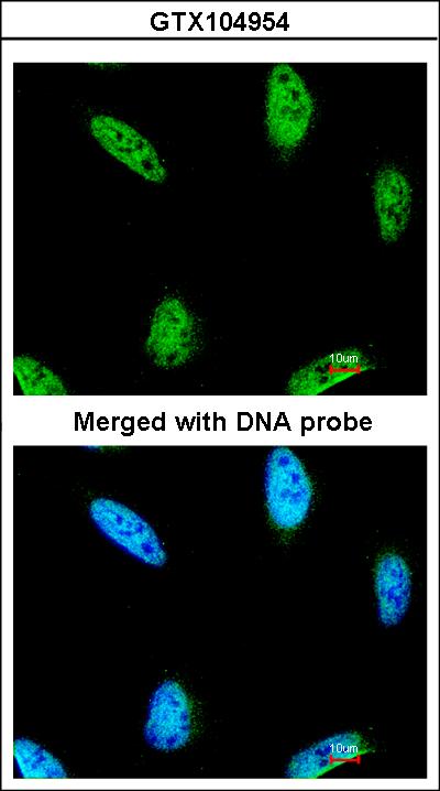 Immunofluorescence of paraformaldehyde-fixed HeLa using IPMK antibody at 1:200 dilution.
