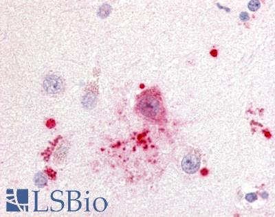 Anti-GPR88 antibody LS-A6324 IHC of human brain, neurons and glia. Immunohistochemistry of formalin-fixed, paraffin-embedded tissue after heat-induced antigen retrieval.