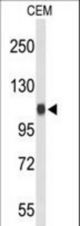 Western blot of IPO11 Antibody in CEM cell line lysates (35 ug/lane). IPO11 (arrow) was detected using the purified antibody.
