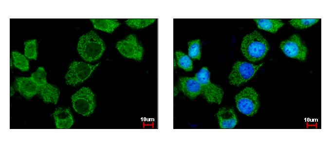 Importin 7 antibody [C3], C-term detects IPO7 protein at cytoplasm by immunofluorescent analysis. A431 cells were fixed in 4% paraformaldehyde at RT for 15 min. IPO7 protein stained by Importin 7 antibody [C3], C-term diluted at 1:500. 