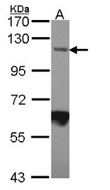 Sample (30 ug of whole cell lysate). A: JurKat. 7.5% SDS PAGE. IPO7 / RANBP7 antibody diluted at 1:1000.