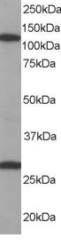 Antibody staining (0.1 ug/ml) of Human Brain lysate (RIPA buffer, 35 ug total protein per lane). Primary incubated for 1 hour. Detected by Western blot of chemiluminescence.