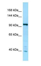 IPO7 / RANBP7 antibody Western Blot of MCF7.