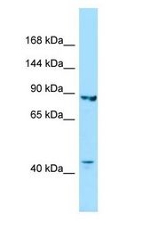 IPO8 / Importin 8 antibody Western Blot of Fetal Kidney.