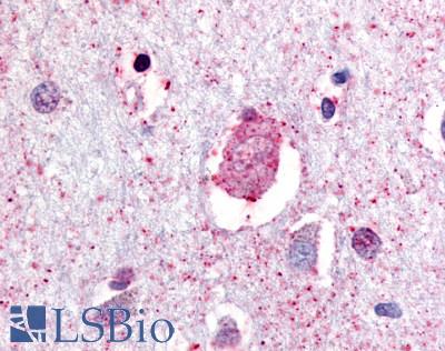 Anti-GPR88 antibody LS-A1572 IHC of human brain, neurons and glia. Immunohistochemistry of formalin-fixed, paraffin-embedded tissue after heat-induced antigen retrieval.