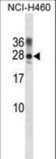RAT Ppp1r2 Antibody western blot of NCI-H460 cell line lysates (35 ug/lane). The RAT Ppp1r2 antibody detected the RAT Ppp1r2 protein (arrow).