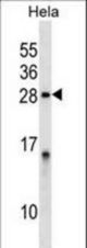 PPP1R2 Antibody western blot of HeLa cell line lysates (35 ug/lane). The PPP1R2 antibody detected the PPP1R2 protein (arrow).