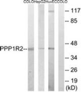 Western blot of extracts from HUVEC/HepG2/COLO cells, using PPP1R2 Antibody. The lane on the right was incubated with synthetic peptide.