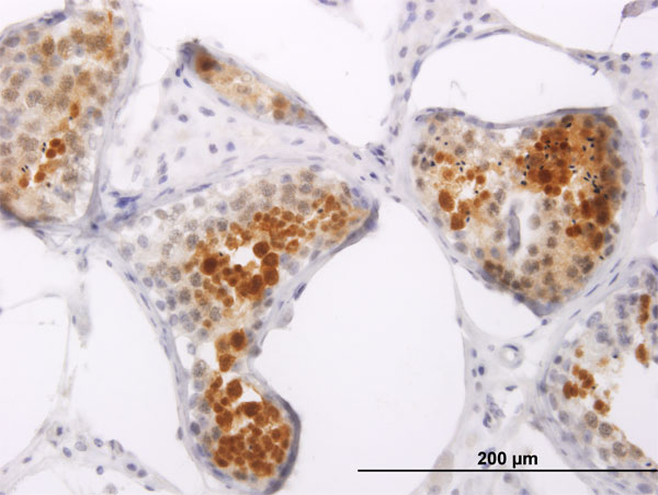 Immunoperoxidase of monoclonal antibody to PPP1R2P3 on formalin-fixed paraffin-embedded human testis. [antibody concentration 3 ug/ml]