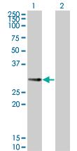 Western blot of PPP1R2P3 expression in transfected 293T cell line by PPP1R2P3 monoclonal antibody (M01), clone 2G11.