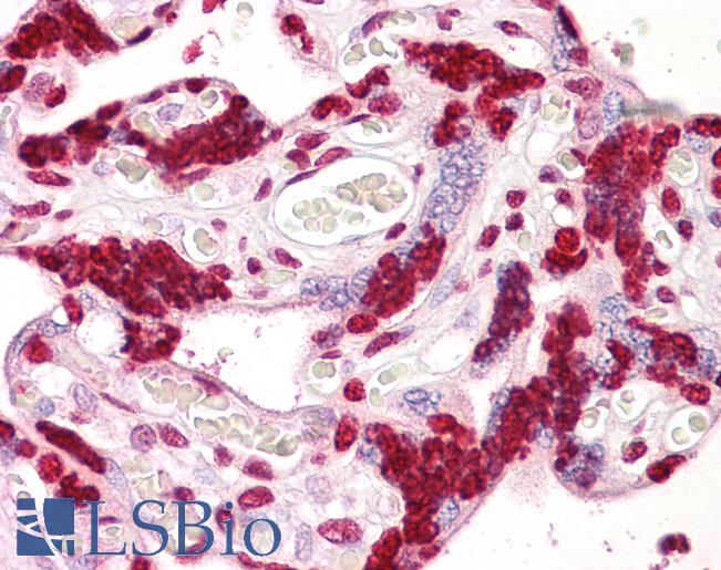 Anti-PPP1R2 antibody IHC of human placenta. Immunohistochemistry of formalin-fixed, paraffin-embedded tissue after heat-induced antigen retrieval. Antibody LS-B7663 concentration 10 ug/ml.