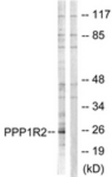 Western blot of extracts from Jurkat cells, using PPP1R2 Antibody. The lane on the right is treated with the synthesized peptide.