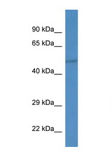 IPPK antibody LS-C135457 Western blot of Mouse Liver lysate. Antibody concentration 1 ug/ml.
