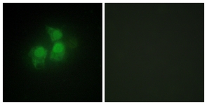 Immunofluorescence of HepG2 cells, using IPPK Antibody. The picture on the right is treated with the synthesized peptide.