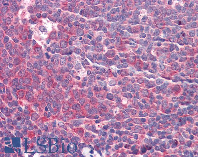 Anti-GOLM1 / GOLPH2 antibody IHC of human tonsil. Immunohistochemistry of formalin-fixed, paraffin-embedded tissue after heat-induced antigen retrieval. Antibody LS-B5799 concentration 5 ug/ml.