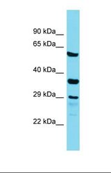 Western blot of Human Placenta. IQCC antibody dilution 1.0 ug/ml.