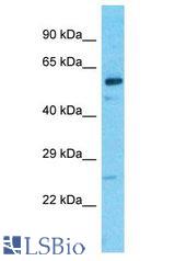 IQCC antibody Western Blot of MCF7. Antibody dilution: 1 ug/ml.
