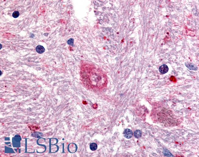 Anti-GPR88 antibody LS-A6318 IHC of human brain, caudate. Immunohistochemistry of formalin-fixed, paraffin-embedded tissue after heat-induced antigen retrieval.