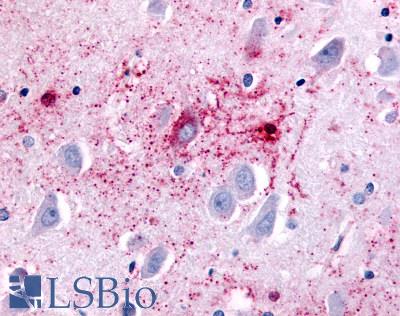 Anti-GPR89A antibody LS-A1734 IHC of human brain, hippocampus. Immunohistochemistry of formalin-fixed, paraffin-embedded tissue after heat-induced antigen retrieval.