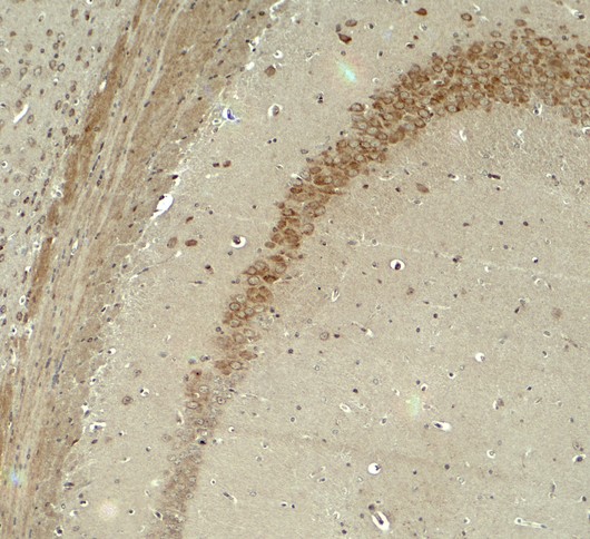 Immunohistochemistry of IQSEC2 in mouse brain tissue with IQSEC2 antibody at 5 ug/ml.