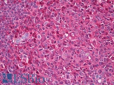 Anti-IQSEC2 antibody IHC of human tonsil, germinal center. Immunohistochemistry of formalin-fixed, paraffin-embedded tissue after heat-induced antigen retrieval. Antibody LS-B7820 dilution 5 ug/ml.